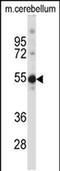 Testis-specific Y-encoded-like protein 5 antibody, PA5-48599, Invitrogen Antibodies, Western Blot image 