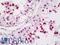 Ly1 Antibody Reactive antibody, LS-B11367, Lifespan Biosciences, Immunohistochemistry paraffin image 