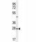 Endothelin-3 antibody, F40093-0.4ML, NSJ Bioreagents, Western Blot image 