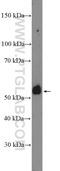 Transmembrane Serine Protease 4 antibody, 11283-1-AP, Proteintech Group, Western Blot image 