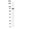 Potassium Voltage-Gated Channel Subfamily Q Member 2 antibody, R31423, NSJ Bioreagents, Western Blot image 