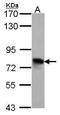 Transforming Growth Factor Beta Induced antibody, PA5-27261, Invitrogen Antibodies, Western Blot image 