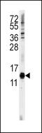 Cytidine Deaminase antibody, 61-564, ProSci, Western Blot image 