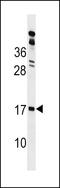 GLIPR2 antibody, LS-C159708, Lifespan Biosciences, Western Blot image 
