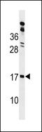 GLI Pathogenesis Related 2 antibody, LS-C159708, Lifespan Biosciences, Western Blot image 