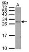 CD99 Molecule (Xg Blood Group) antibody, GTX113359, GeneTex, Western Blot image 
