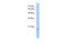 Deoxynucleotidyltransferase Terminal Interacting Protein 1 antibody, 30-655, ProSci, Western Blot image 