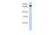 Zinc Finger Protein 33A antibody, A12645, Boster Biological Technology, Western Blot image 