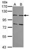 MutS Homolog 2 antibody, PA5-29160, Invitrogen Antibodies, Western Blot image 