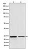Trp antibody, M07468, Boster Biological Technology, Western Blot image 