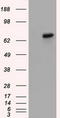 Bruton Tyrosine Kinase antibody, LS-C115157, Lifespan Biosciences, Western Blot image 