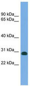 Centromere Protein H antibody, TA344395, Origene, Western Blot image 
