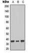 Melatonin Receptor 1B antibody, orb315621, Biorbyt, Western Blot image 