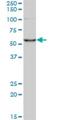 Coronin 1C antibody, H00023603-M02, Novus Biologicals, Western Blot image 