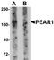Platelet Endothelial Aggregation Receptor 1 antibody, TA326610, Origene, Western Blot image 