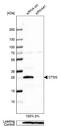 Cathepsin S antibody, NBP1-85807, Novus Biologicals, Western Blot image 