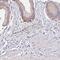 Arginine And Serine Rich Protein 1 antibody, PA5-63639, Invitrogen Antibodies, Immunohistochemistry frozen image 