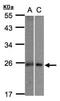 MID1 Interacting Protein 1 antibody, NBP1-32599, Novus Biologicals, Western Blot image 