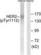 ERBB2 antibody, TA312250, Origene, Western Blot image 