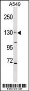 Collagen Type IV Alpha 6 Chain antibody, 59-095, ProSci, Western Blot image 