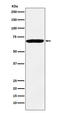 Insulin Like Growth Factor 2 MRNA Binding Protein 3 antibody, M02362-1, Boster Biological Technology, Western Blot image 
