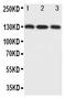 Nitric oxide synthase antibody, PA1330, Boster Biological Technology, Western Blot image 