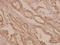 Mechanistic Target Of Rapamycin Kinase antibody, A00003S2442, Boster Biological Technology, Immunohistochemistry frozen image 