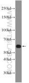 Zinc Finger Protein 211 antibody, 25458-1-AP, Proteintech Group, Western Blot image 