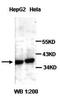Nucleophosmin 1 antibody, orb77174, Biorbyt, Western Blot image 