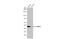 YTH N6-Methyladenosine RNA Binding Protein 2 antibody, GTX636775, GeneTex, Western Blot image 