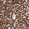 mCAC antibody, NBP1-86689, Novus Biologicals, Immunohistochemistry paraffin image 