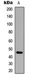 Arrestin Domain Containing 4 antibody, LS-C354537, Lifespan Biosciences, Western Blot image 