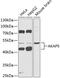 A-Kinase Anchoring Protein 5 antibody, 15-366, ProSci, Western Blot image 