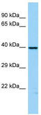 WD Repeat Domain, Phosphoinositide Interacting 2 antibody, TA332246, Origene, Western Blot image 
