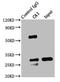Carbonic Anhydrase 1 antibody, LS-C318090, Lifespan Biosciences, Immunoprecipitation image 