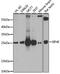 Eukaryotic Translation Initiation Factor 4E antibody, GTX32580, GeneTex, Western Blot image 