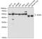 Tryptophanyl-TRNA Synthetase antibody, GTX32939, GeneTex, Western Blot image 