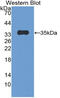 Plakophilin 2 antibody, MBS2028679, MyBioSource, Western Blot image 