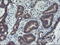 Archain 1 antibody, M08725, Boster Biological Technology, Immunohistochemistry paraffin image 