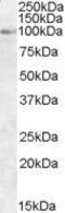 Oxysterol Binding Protein antibody, GTX25915, GeneTex, Western Blot image 