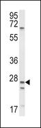 Amiloride-sensitive sodium channel subunit alpha antibody, PA5-35364, Invitrogen Antibodies, Western Blot image 