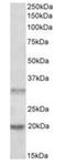 Asparaginase Like 1 antibody, orb19761, Biorbyt, Western Blot image 
