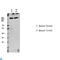 Large Tumor Suppressor Kinase 1 antibody, LS-C813582, Lifespan Biosciences, Western Blot image 