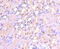 Sp1 Transcription Factor antibody, GTX01012, GeneTex, Immunohistochemistry paraffin image 