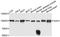 Dystroglycan 1 antibody, A10076, ABclonal Technology, Western Blot image 