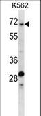 Thyroid Hormone Receptor Interactor 10 antibody, LS-C160215, Lifespan Biosciences, Western Blot image 