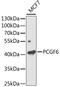 Polycomb Group Ring Finger 6 antibody, A5760, ABclonal Technology, Western Blot image 