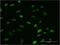 Survival Of Motor Neuron 2, Centromeric antibody, H00006607-M01, Novus Biologicals, Immunofluorescence image 