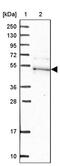 Kaptin, Actin Binding Protein antibody, PA5-59735, Invitrogen Antibodies, Western Blot image 