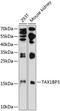 Tax1 Binding Protein 3 antibody, A05588, Boster Biological Technology, Western Blot image 